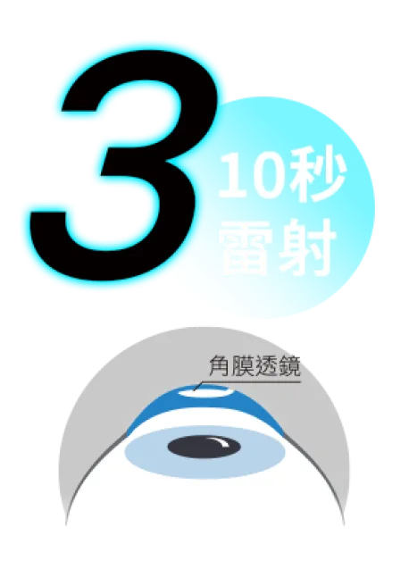 角膜表面下方利用全飛秒,雷射出超薄專利透鏡。