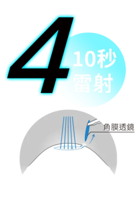 透過約0.2公分微創切口取出角膜透鏡,改善近視、散光與老花視力。