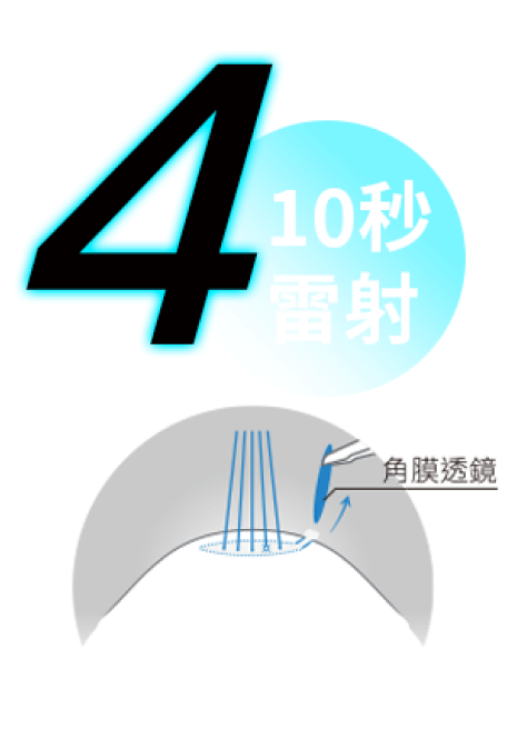 透過約0.2公分微創切口取出角膜透鏡,改善近視、散光與老花視力。