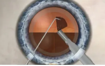 步驟5